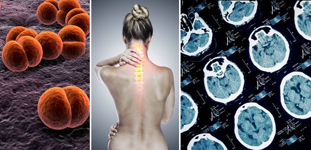 Images of bacteria, woman with highlighted spine, and brain scans